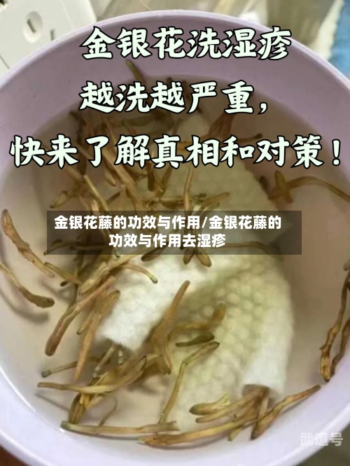 金银花藤的功效与作用/金银花藤的功效与作用去湿疹
